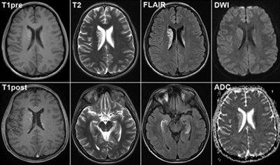 Магнитно-резонансная томография: что показывает МРТ, стоит ли делать МРТ