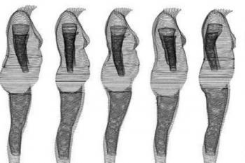Распределение жира по телу