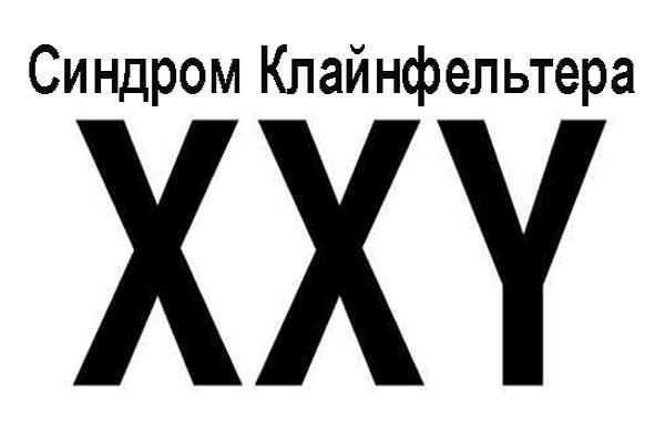 Синдром Клайнфелтера, хромосомы Синдром Клайнфелтера, хромосомы
