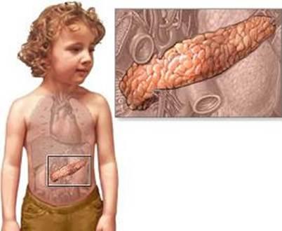 Панкреатит у детей серьезная проблема поджелудочной железы
