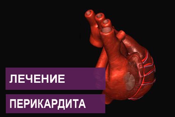 Как лечить перикардит сердца Как лечить перикардит сердца