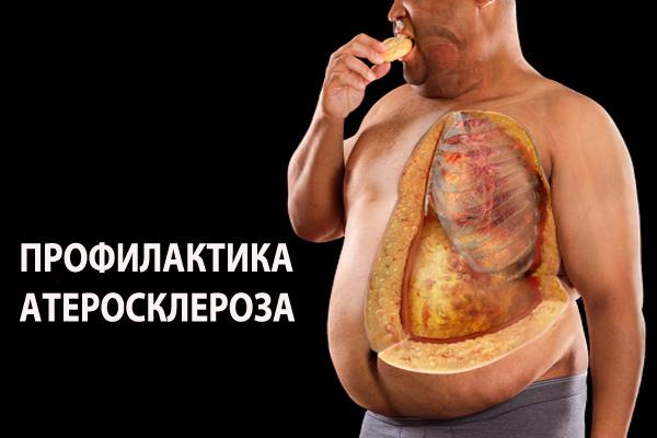 Как предотвратить атеросклероз сосудов Как предотвратить атеросклероз сосудов