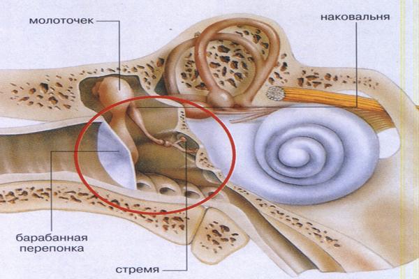 Перфорация барабанной перепонки