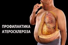 Как предотвратить атеросклероз сосудов Как предотвратить атеросклероз сосудов