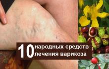 10 лучших народных средств лечения варикозного расширения на ногах 10 лучших народных средств лечения варикозного расширения на ногах