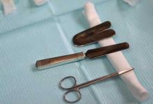 Преимущества и недостатки обрезания у мужчин
