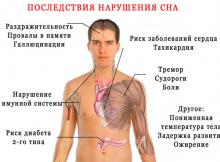 Сон подростка Сон подростка